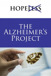 The Alzheimer's Project