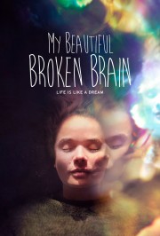 My Beautiful Broken Brain-voll