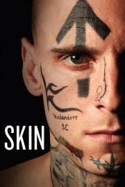 watch Skin free online