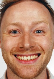 Limmy's Show