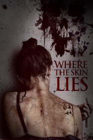 Watch Free Where the Skin Lies Movies HD Online FMovies Alternatives site