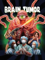 Brain Tumor Brain Tumor